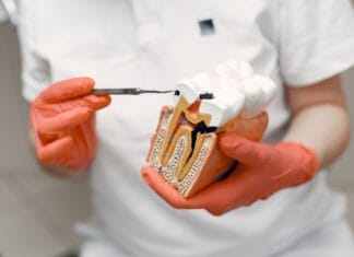 Leczenie kanałowe krok po kroku – kiedy jest konieczne i jak przebiega zabieg Dentysta trzyma model zęba, ilustrując leczenie kanałowe